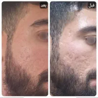 پکیج ترمیم پوست|آرایشی، بهداشتی، درمانی|سقز, |دیوار