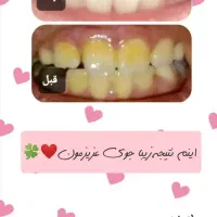 برای استفاده شخصی پک دهان دندان