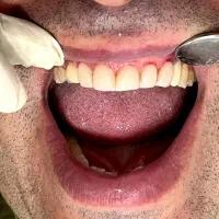 دندانپزشکی بزرگسال و اطفال