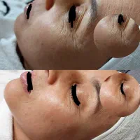 فیشال تخصصی(پاکسازی پوست)۳۰۰تومان