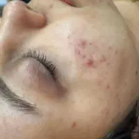 جشنواره بزرگ مرکز زیبایی پرستو طاهری .تی تی ساvip