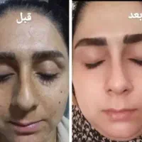 کرم شب|آرایشی، بهداشتی، درمانی|قم, شاه ابراهیم|دیوار