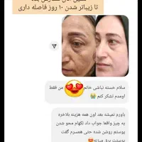 کرم فوقالعاده قوی ویکتور قیمت یک میلیون .|حراج|بروجرد, |دیوار