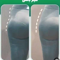 تزریق ژل وفیلر بادی و نخ و لیزر با دستگاه الکس۲۰۲۳|خدمات آرایشگری و زیبایی|تهران, تهرانپارس غربی|دیوار