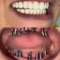 کلینیک تخصصی دندانپزشکی و ایمپلنت در سیرجان