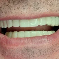 کامپوزیت زیبایی|خدمات آرایشگری و زیبایی|اسلامشهر, شهرک قائمیه|دیوار