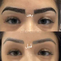 کاشت ابرو فقط ۱۴۹۰۰ با دو جلسه مزو رایگان|خدمات آرایشگری و زیبایی|مشهد, طلاب|دیوار