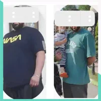 لاغری تضمینی رفع علت اضافه وزن