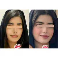 فروش محصولات چاقی و لاغری