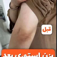مثل برف سفید شو|آرایشی، بهداشتی، درمانی|قم, سراجه|دیوار