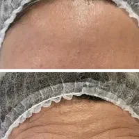 تمامی خدمات با اف  ژل بوتاکس ،ناخن ،  تتو|خدمات آرایشگری و زیبایی|ایذه, |دیوار