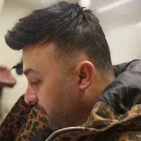 نصب پروتز مو با بهترین متریال