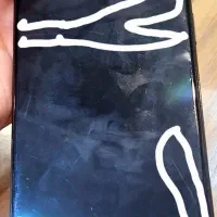 Redmi Note 11 نیازمند تعمیر