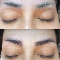 ریموابرو بالیزر کیوسویچ پیکوشور