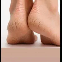 کفسابی پا،