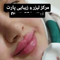 خدمات ژل بوتاکس چربی با زیباترین نتایج وقیمت مناسب|خدمات آرایشگری و زیبایی|دوگنبدان, |دیوار