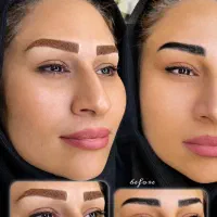 میکرو و روشن سازی تتوهای قدیمی بدون ریمو