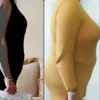 لاغری و افتادگی شکم،سینه|خدمات آرایشگری و زیبایی|رشت, انصاری|دیوار