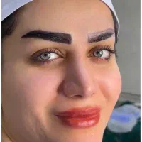 کاشت مو ابرو مژه