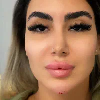 بوتاکس فیلرژل لب گونه چانه زاویه فک و صورت مادلینگ|خدمات آرایشگری و زیبایی|تهران, تهرانپارس غربی|دیوار