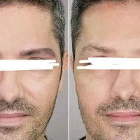 رفع نواقص ابرو در اقایان/میکرو /لیفت ابرو|خدمات زیبایی و سلامت|تبریز, |دیوار