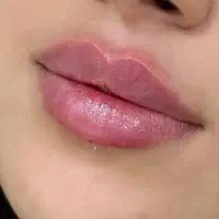 تزریق ژل لب روسی،و بوتاکس و فیلر و مادلینگ