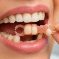 جای خالی دندانت رو سریع پر کن /فقط ۶ میلیون