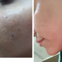 جشنواره فشیال الگاپیل ترکیبی ضدلک چروک منافذ اموزش