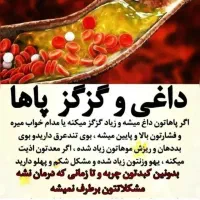 داغی کف پا