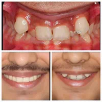 ارتودنسی ارزانتر از تعرفه نظام پزشکی،ایمپلنت فوری|خدمات آرایشگری و زیبایی|تهران, آذربایجان|دیوار