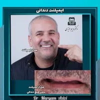 دندانپزشکی ترمیم دندان با مواد کامپوزیت دندان|خدمات آرایشگری و زیبایی|شیراز, معالی‌آباد|دیوار