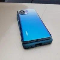 گوشی شیائومی می ۱۱