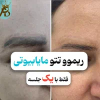 پاک کردن تتو خالکوبی،ریموو تتو ابروـ بدن مایابیوتی|خدمات آرایشگری و زیبایی|یاسوج, |دیوار