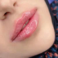 آموزش ژل و بوتاکس|خدمات آموزشی|شیراز, زرهی|دیوار