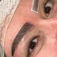 کاشت ابرو در قم و تهران