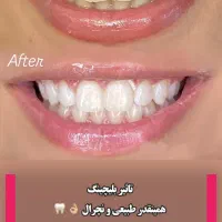 تخفیف خدمات دندانپزشکی|خدمات آرایشگری و زیبایی|رشت, گلسار|دیوار