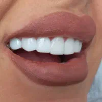 دندان پزشکی و کامپوزیت دندان در یاسوج|خدمات آرایشگری و زیبایی|دوگنبدان, |دیوار