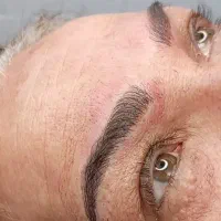 مدل میکروبلیدینگ و میکروپیگمنتیشن