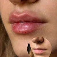 تزریق ژل و بوتاکس و جوانساز|خدمات آرایشگری و زیبایی|تهران, کیانشهر|دیوار