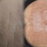 جوانسازی فیان مزو تکنیک فی پاکسازی آقا و خانوم ها|خدمات آرایشگری و زیبایی|قم, صفائیه|دیوار
