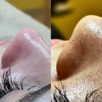 فشیال و پاکسازی تخفیفات ویژه عید فقط تا یکشنبه