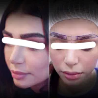 اقساطی/کاشت مو تضمینی/کاشت ابرو/ژل لب|خدمات آرایشگری و زیبایی|سنندج, |دیوار