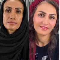 ژل لب و صورت اودری فقط هزینه مواد ۳۹۰ ت|خدمات آرایشگری و زیبایی|تهران, نارمک|دیوار