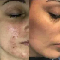 سم زدائی بدن