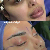 جراحی زیبایی فقط ۶۵میلیون