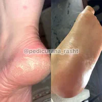 مدل برای پدیکور پا و پارافین تراپی دست و پا|خدمات آرایشگری و زیبایی|رشت, دیلمان|دیوار