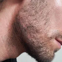 تزریق ژل لب وکانتورینگ(+بوتاکس رایگان|خدمات آرایشگری و زیبایی|کرمانشاه, |دیوار