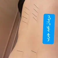 طب سوزنی،زالو درمانی،حجامت|خدمات آرایشگری و زیبایی|تربت جام, شهید نصرالهی|دیوار