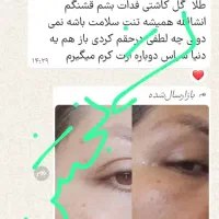 کرم شب مروه گلی