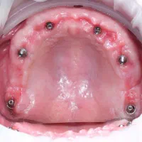 تخفیف و اقساط بلند مدت کلینیک دی|خدمات آرایشگری و زیبایی|آذرشهر, |دیوار